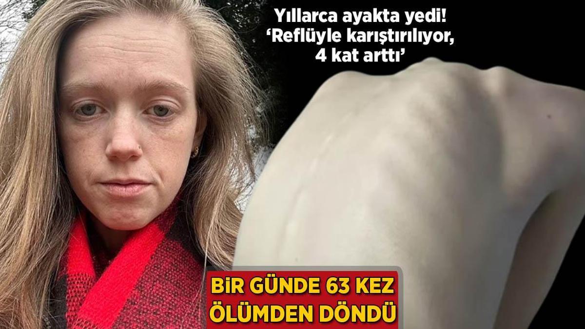 Bir günde 63 kez ölümden döndü! Yıllarca ayakta yedi: ‘Reflüyle karıştırılıyor, 4 kat arttı’